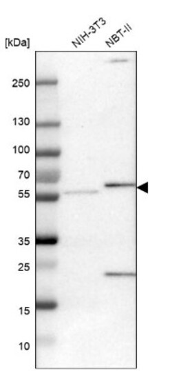 Pyruvate Dehydrogenase Phosphatase/PDP1/PPM2C Antibody, Novus Biologicals